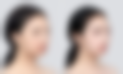 上海卫邦门整形医院价格表