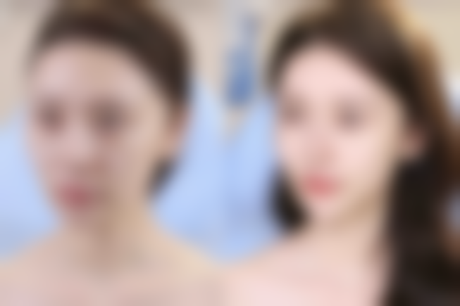 三、益阳康雅医院整形美容中 心怎么样——口碑评价