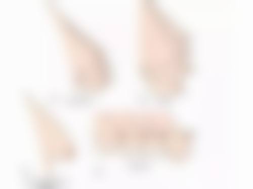 张云侠医生项目优势