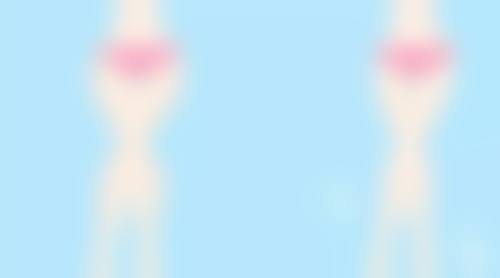 三等甲医院王牌去眼袋泪沟方案：激光+玻尿酸“黄金组合”