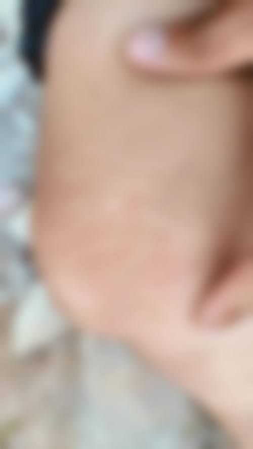 天津高丽美迹皮肤美容诊所怎么样，价格表