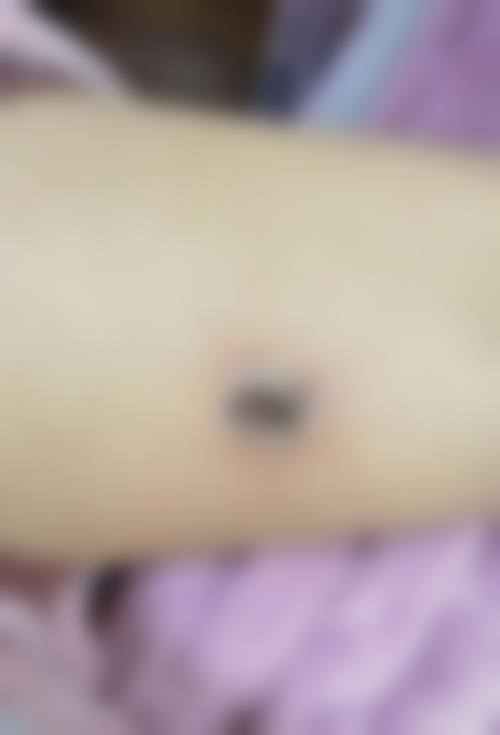 广西春妮医疗美容诊所怎么挂号，地址在哪儿