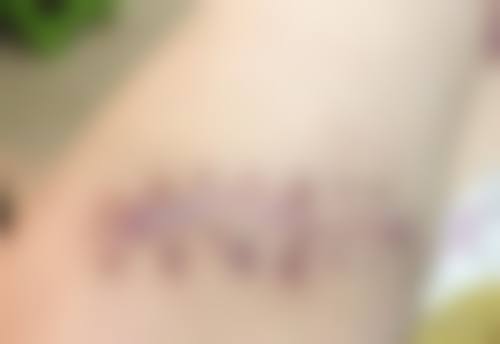 辛海龙医生怎么挂号