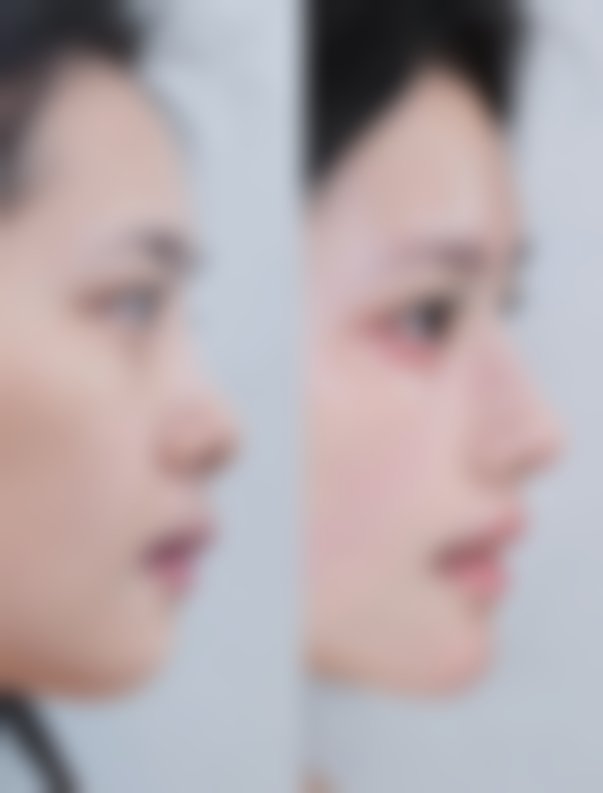 成都玉貌花容整形医院价格表