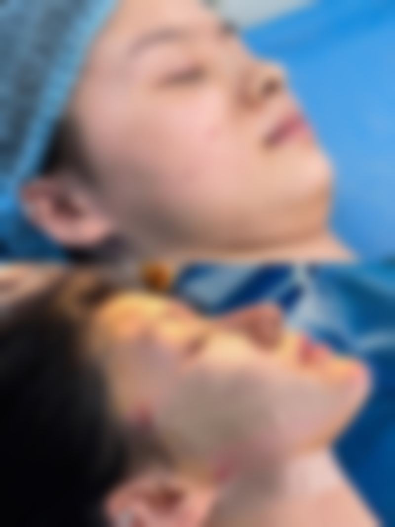 莆田陈奕羽医疗美容诊所价格表