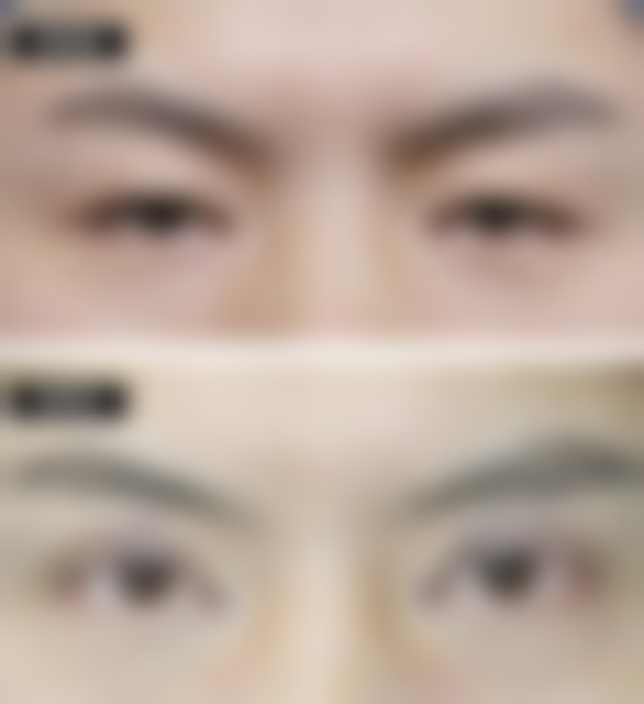 上海艾歌医疗美容（蛋白皮肤连锁）正规吗