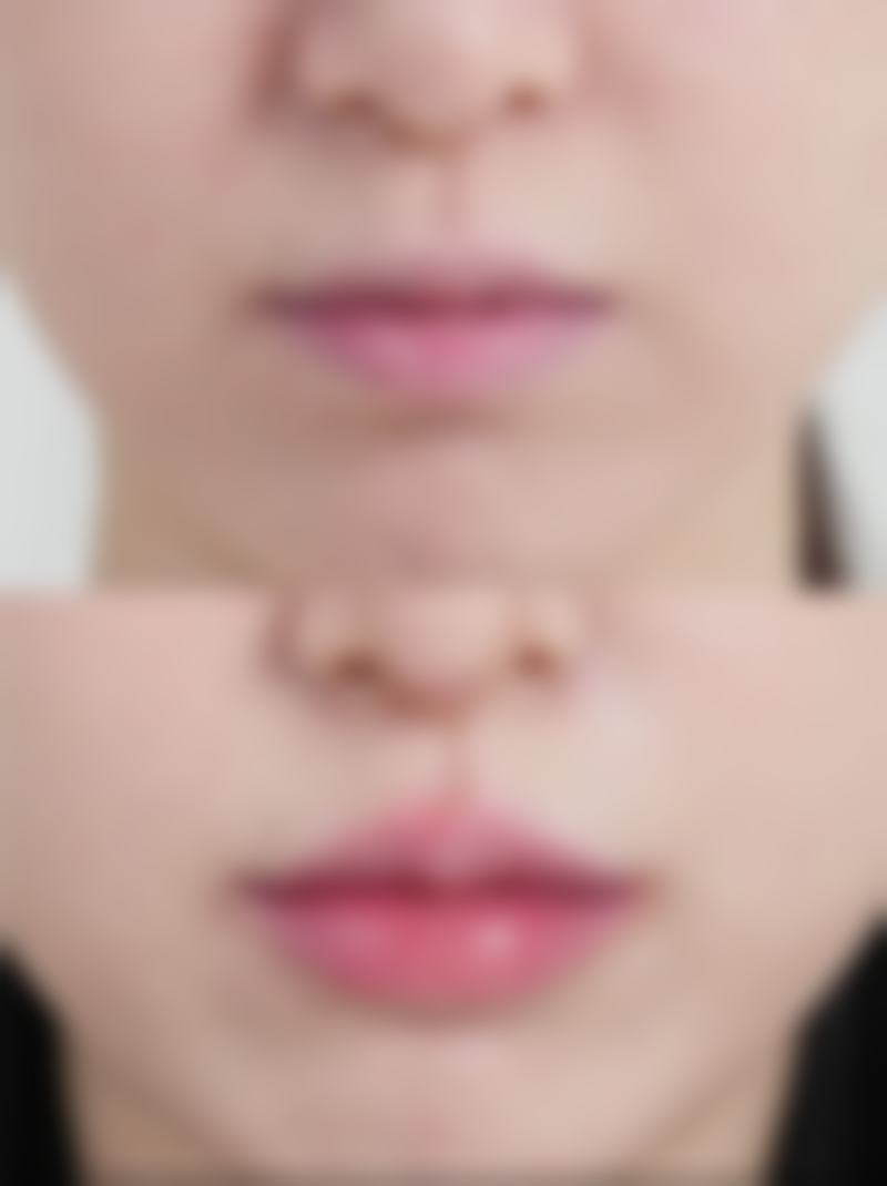 张云侠医生顾客实例图片