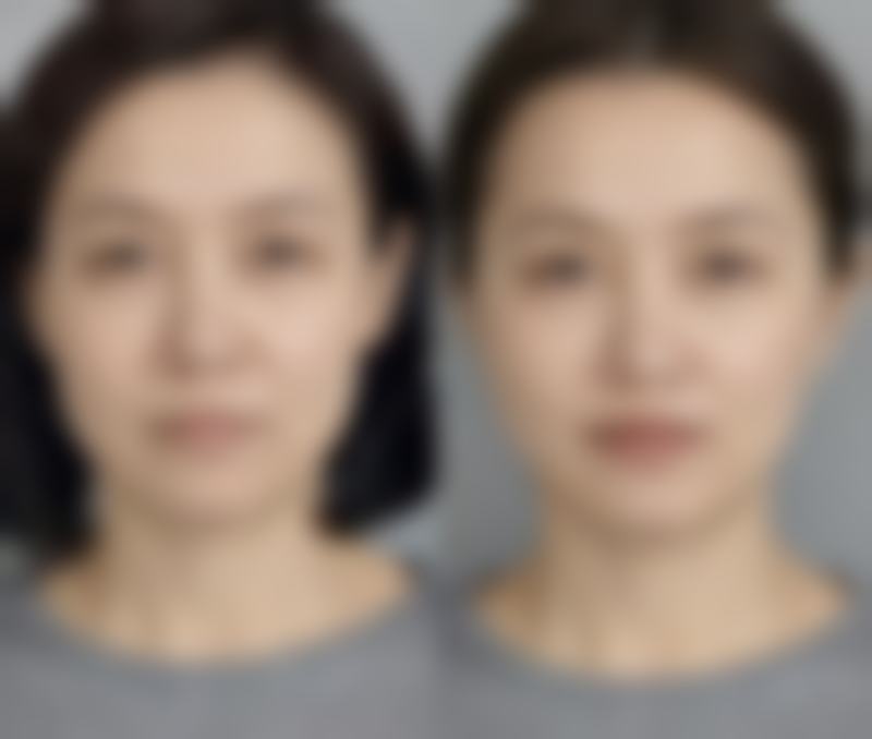 许蕊医生做手术价格