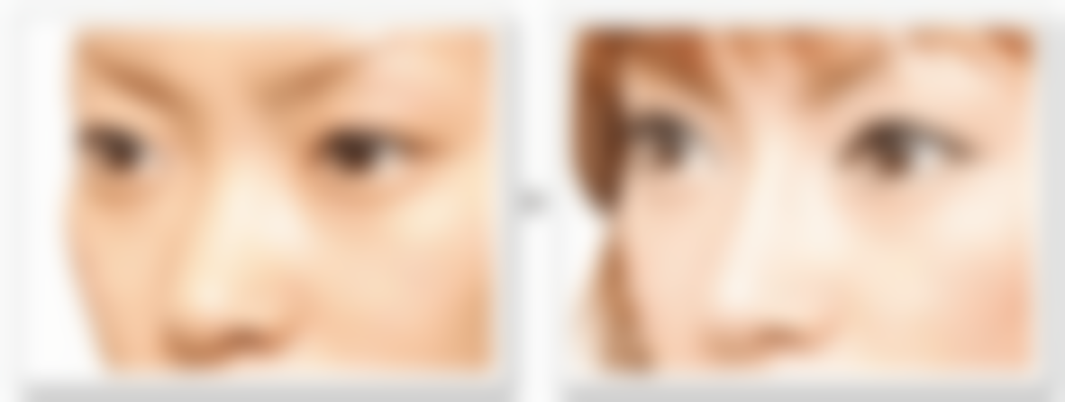 上海市彭才学主攻吸脂项目之魅力揭秘