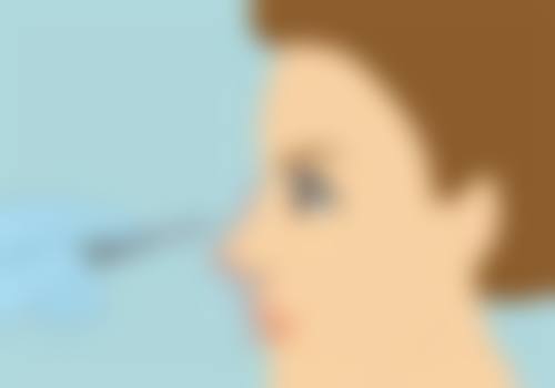 做眼袋手术大概需要多久恢复？内切1周外切3月，三甲医院VS专业整形区别大揭秘