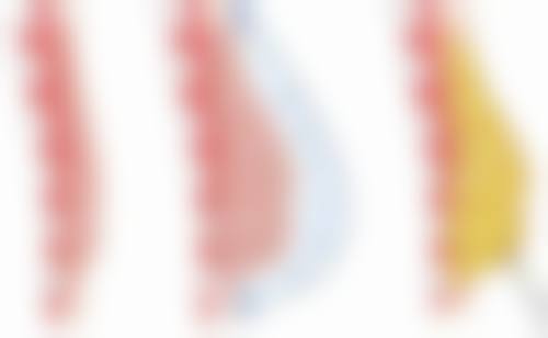 做完双眼皮一个月哭了会影响效果吗？术后护理+冷敷消肿技巧帮你稳住双眼皮形态