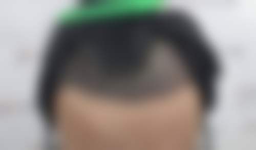 白卫峰医生简介项目优势