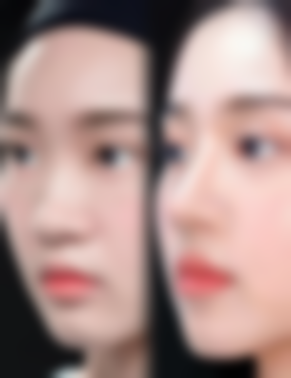 韩国EU颌面轮廓整形外科的抖音团购活动及价格表情况怎么样