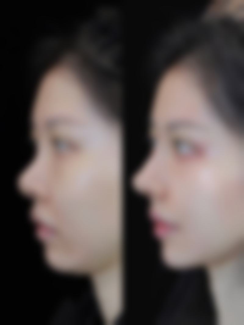 赵晓晖医生顾客实例图片