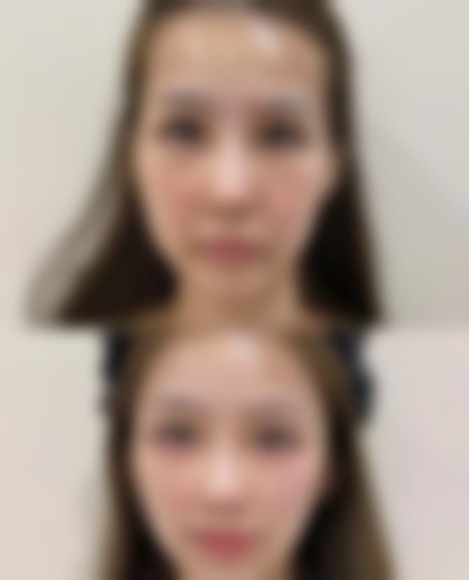 韩国美人整形外科医院 