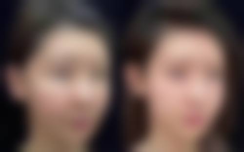 罗杨医生怎么挂号