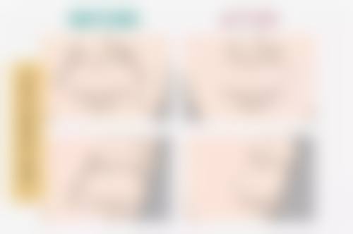 唐田医生做手术价格