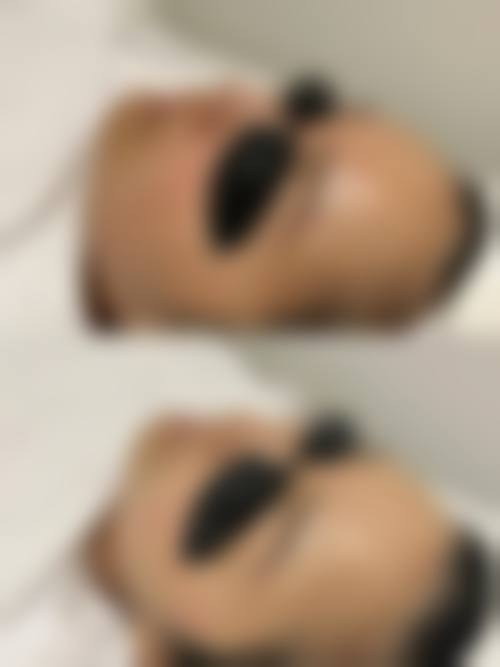 杭州艾丽娅医疗美容诊所价格表情况