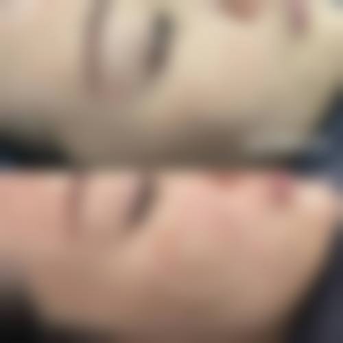 卫咏梅医生做手术价格