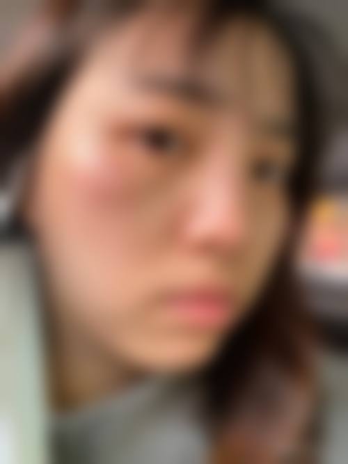 王力佳医生简介口碑如何