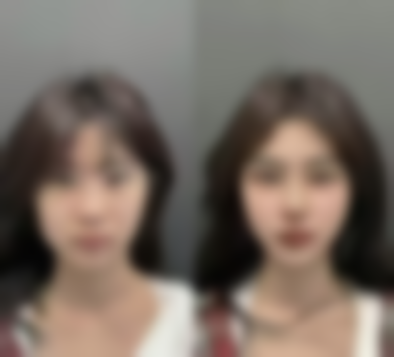 罗杨医生做手术价格