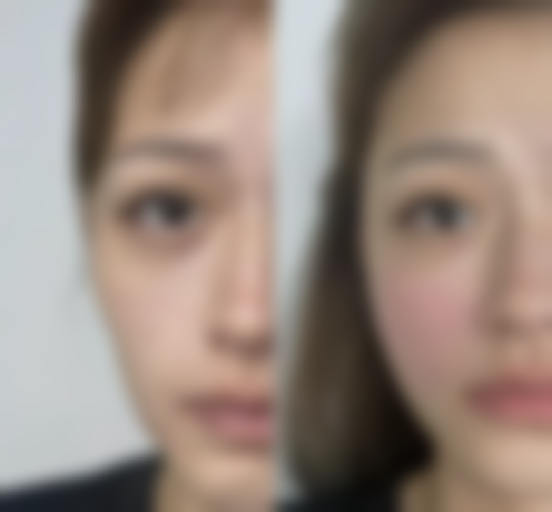 袁定芬医生简介项目优势