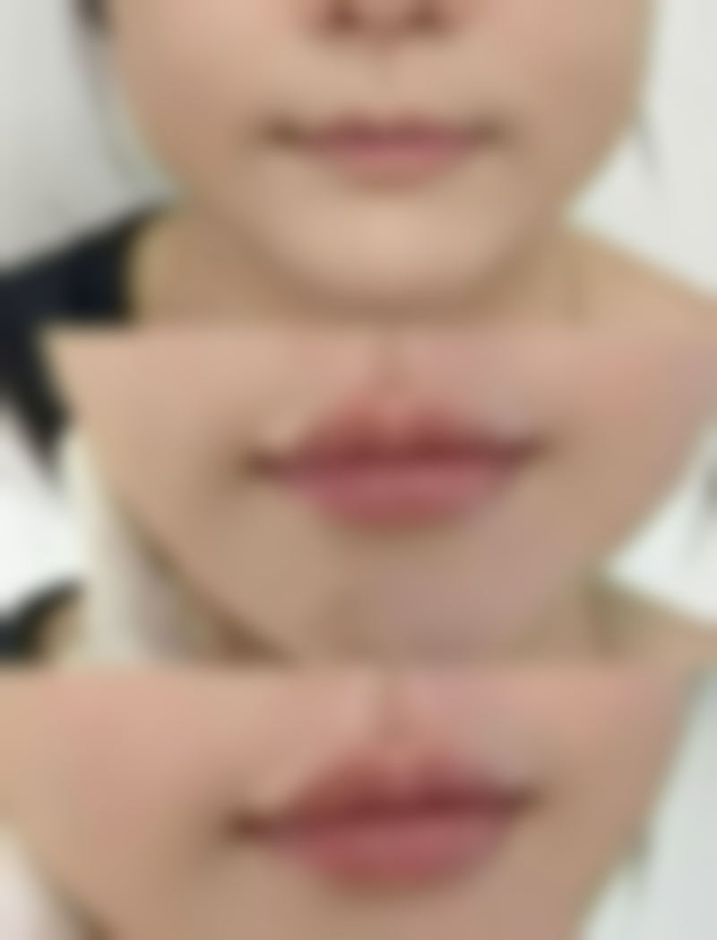 胡国强医生顾客实例图片