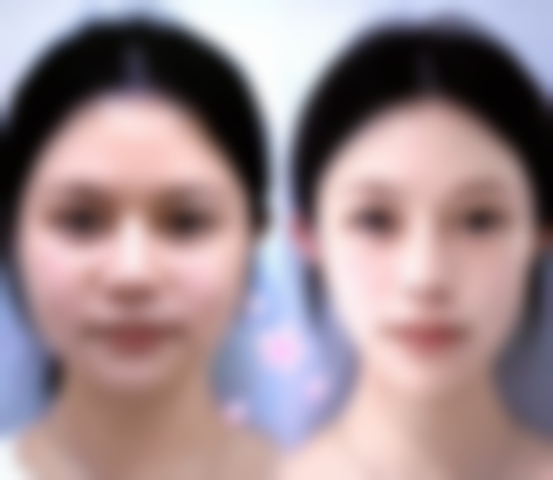 疤痕有什么方法可以去掉——硅酮凝胶：萌大夫®皮美欣的24小时隐形“疤痕创可贴”