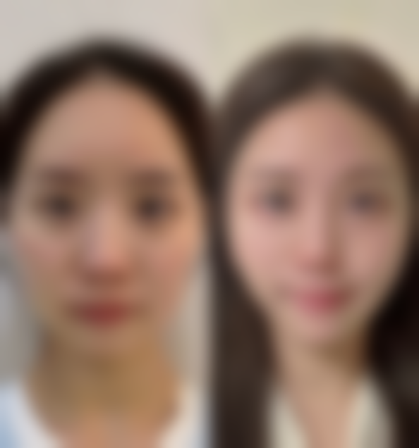 胡文星医生简介做手术价格