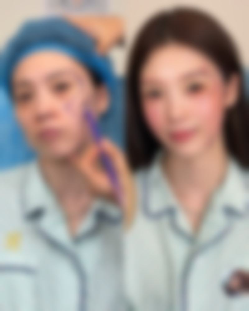 胸前长痘痘有疤痕疙瘩如何去除？北京协和91.7%治愈率方案揭秘