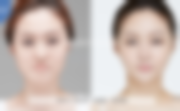 韩国REGEN丽珍整形外科医院口碑评价如何