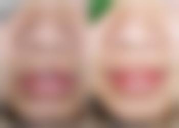 王月君医生项目优势