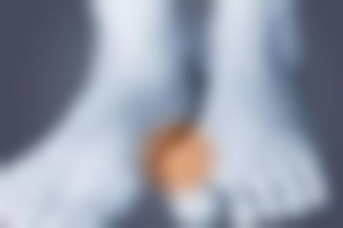 金泰焕医生简介项目优势