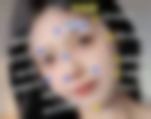 红霉素软膏可以祛眼袋吗？与其他方法大对比