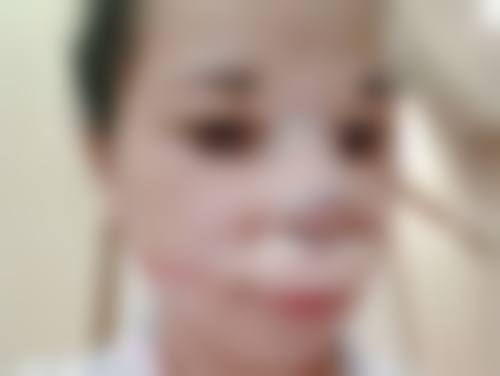 选择医生：比手术方式更重要的决定因素