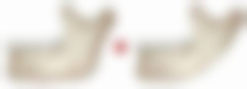 结语：科学祛眼袋，远离偏方陷阱