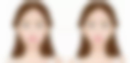 红霉素软膏可以祛眼袋吗？见效时间成泡影