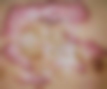 金世咏医生简介项目优势