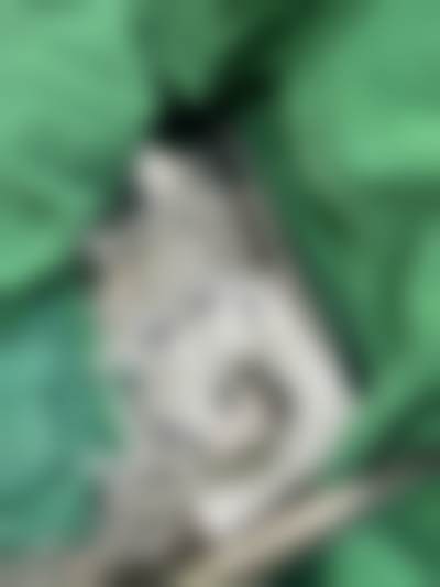 S女性医院李惠妍收费价目表——其他相关实例分享及提醒