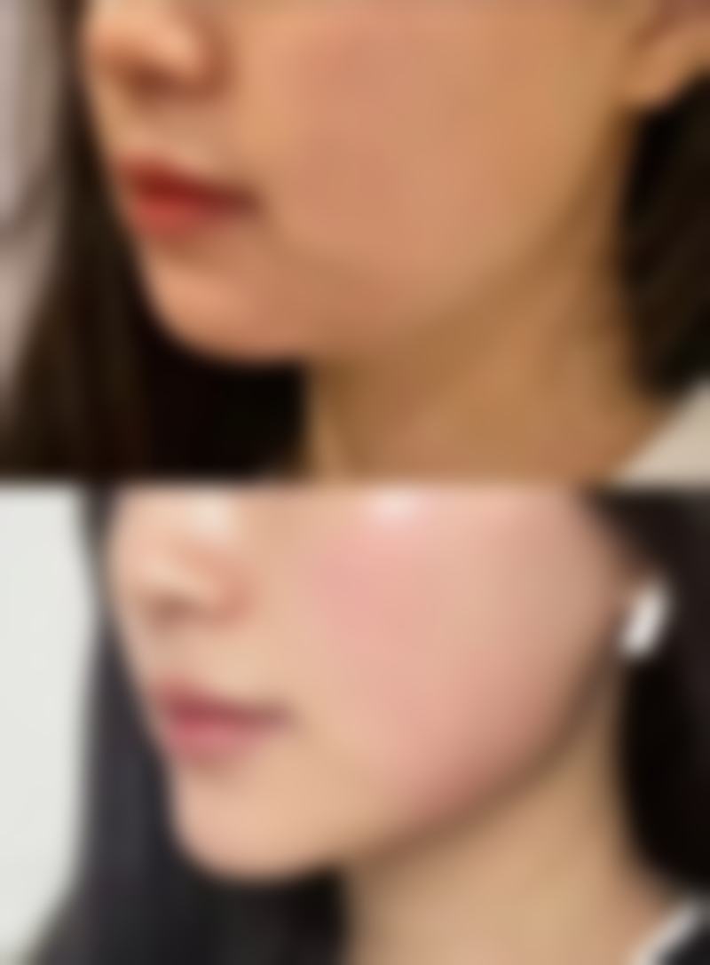 术后护理：让成效更理想的加分项