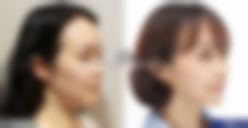 徐淑娜医生简介做手术价格