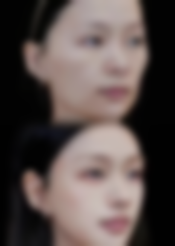 福州优美整形医疗美容诊所怎么样，可靠吗