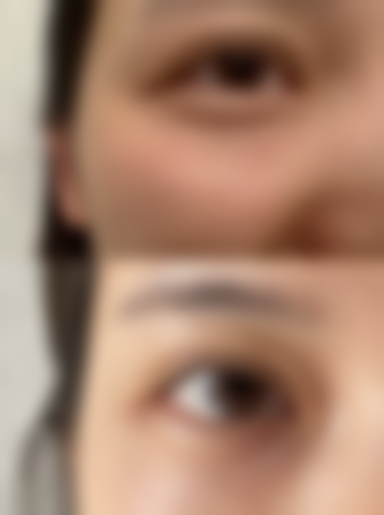 佛山远大医院医疗美容科口碑评价如何