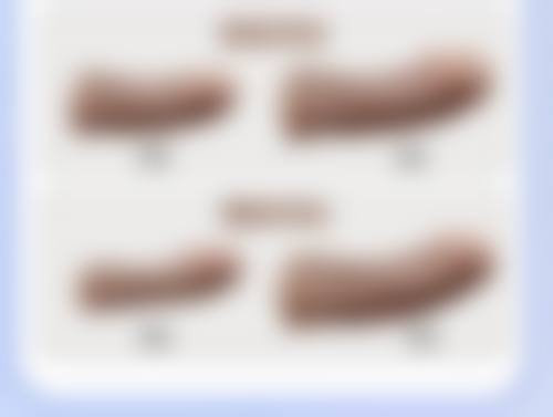 如何更有效的用按摩去眼袋：穴位按摩全图解