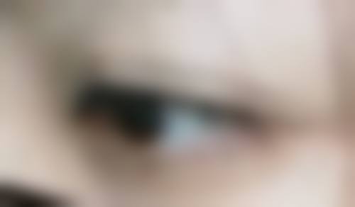 国有医院 vs 私立医院，面部抽脂一般要多少及如何选择