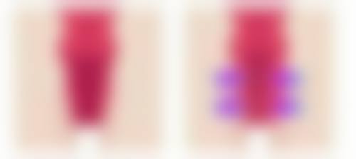 如何更有效的去水肿型眼袋：按摩+冷敷=立竿见影