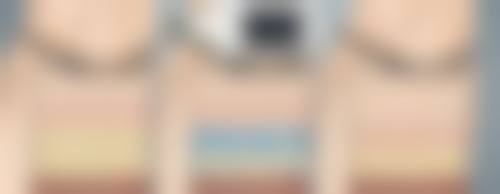 如何更有效的去遗传性眼袋：手术是终极武器？