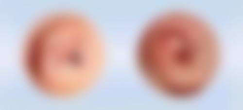 邹锐医生简介口碑如何