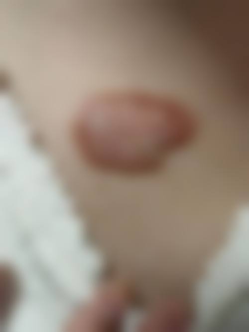 南宁伊美医疗美容诊所更擅长什么手术