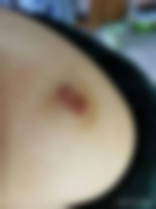 邹锐医生简介怎么挂号